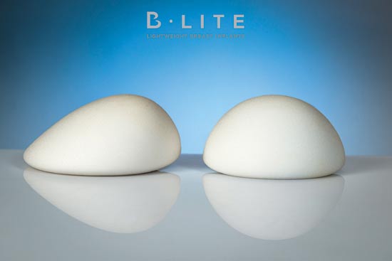 שתלי B-LITE , השתלים הקלים בעולם / צילום: אילוסטרציה שתלי B-LITE , השתלים הקלים בעולם / צילום: אילוסטרציה