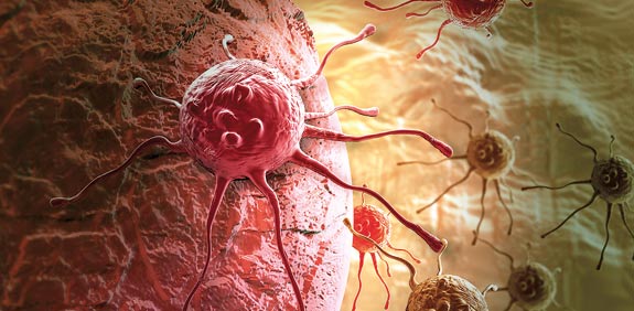 סרטן, תאי גזע, ביומד / צילום: thinkstock