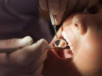 טיפול שיניים / צילום אילוסטרציה:  Shutterstock/ א.ס.א.פ קרייטיב