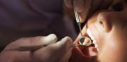 טיפול שיניים / צילום אילוסטרציה:  Shutterstock/ א.ס.א.פ קרייטיב