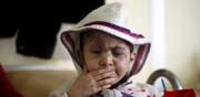 ילד סורי בן 5 שאיבד את עינו בקרבות   / צילום:רויטרס