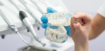 יש לברר אם הרופא עבר הכשרה להשתלת שיניים/ צילום:Shutterstock/ א.ס.א.פ קרייטיב
