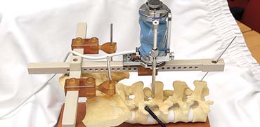 מערכת ניתוח של מזור לעמוד השדרה / צילום: איל יצהר