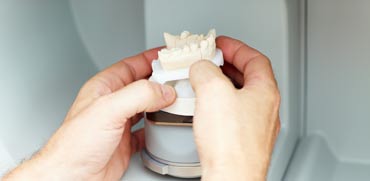 השתלות שיניים/צילום: Shutterstock/ א.ס.א.פ קרייטיב השתלות שיניים/צילום: Shutterstock/ א.ס.א.פ קרייטיב