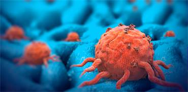 סרטן הלבלב. הטיפול הרופתי החדש מעניק תקווה/צילום: Shutterstock/ א.ס.א.פ קרייטיב
