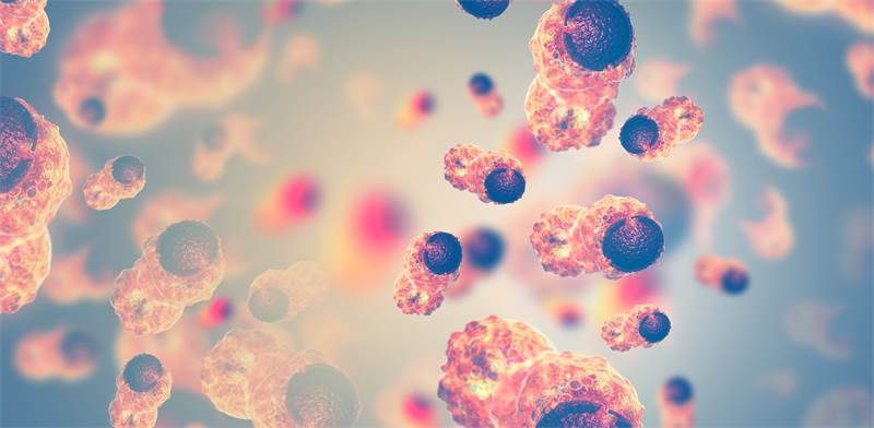 Cancerous cells Photo: Shutterstock